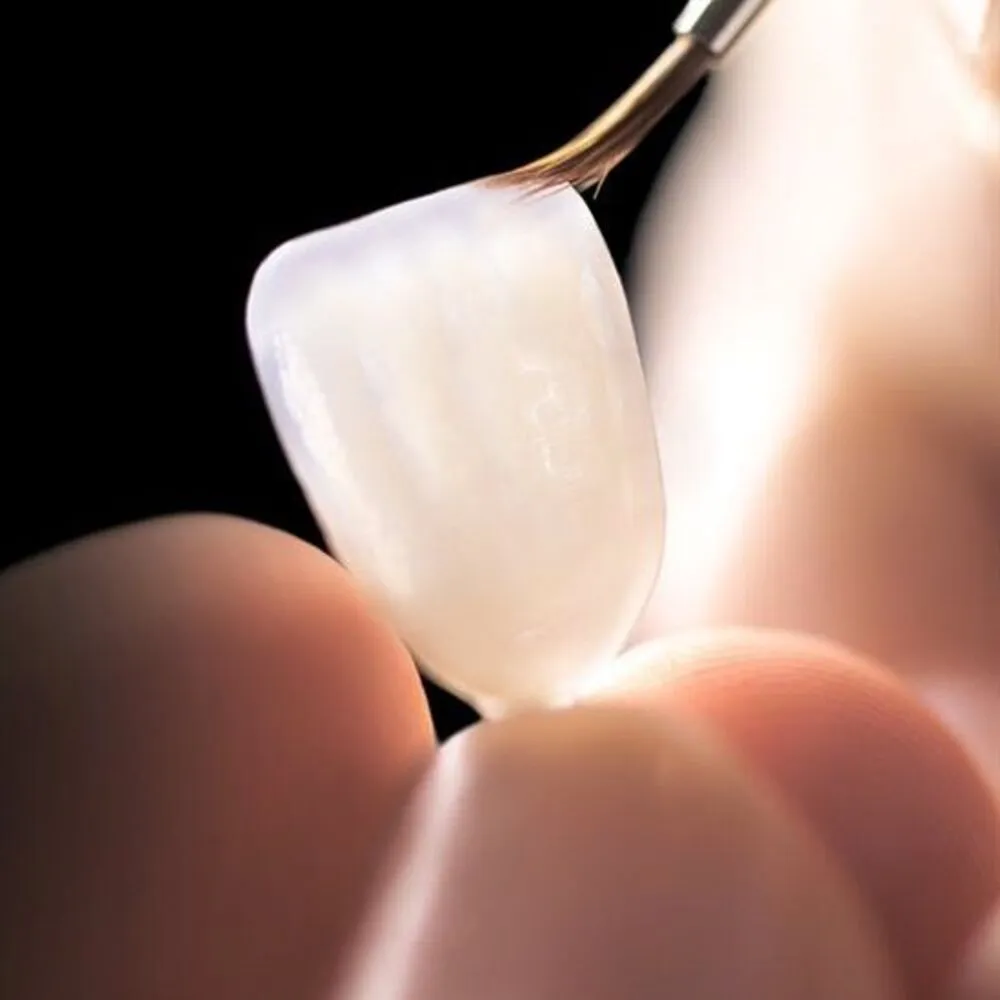 clinica dental fernandez baca prostodoncia tratamiento
