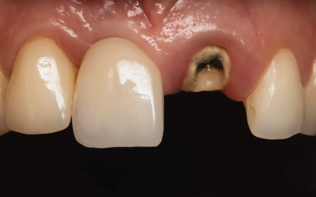 La historia de Rocío: volver a sonreir en un solo día.