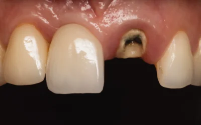 La historia de Rocío: volver a sonreir en un solo día.